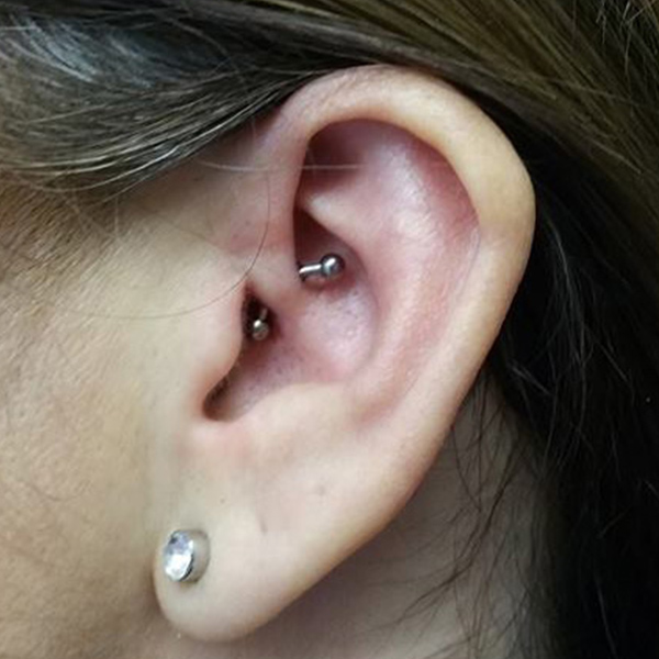 daith piercing by doctor