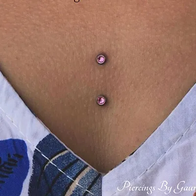 nipples