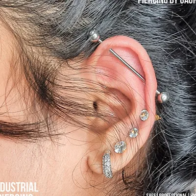 dermal anchor